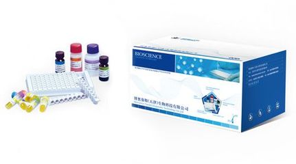 人類免疫缺陷病毒(HIV)抗原及抗體聯(lián)合檢測(cè)試劑盒(化學(xué)發(fā)光法)_博奧賽斯